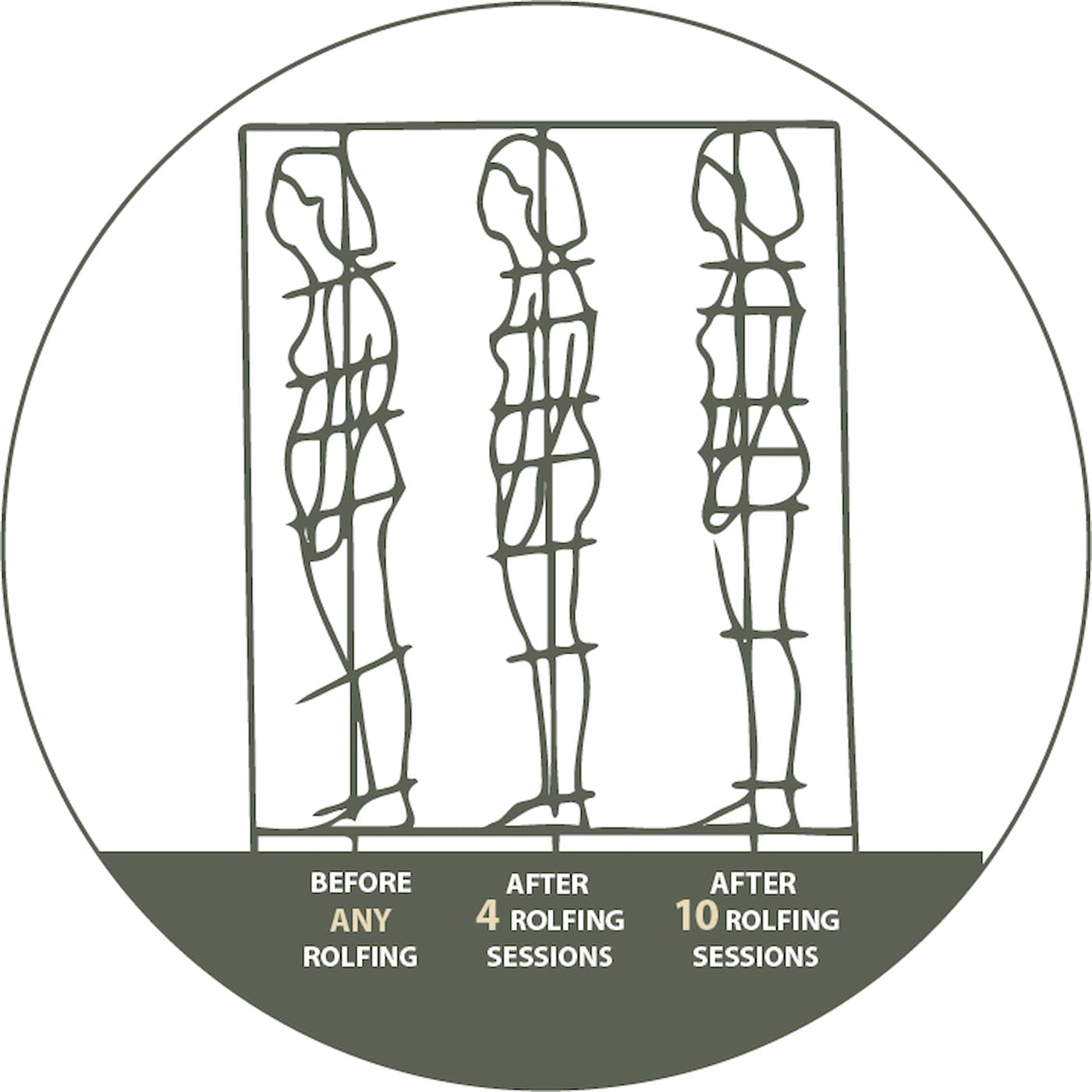 Posture Improvement from Rolfing over Time